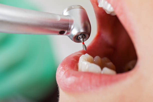 Best Cracked Tooth Emergency Dentist  in Eureka Mill, SC